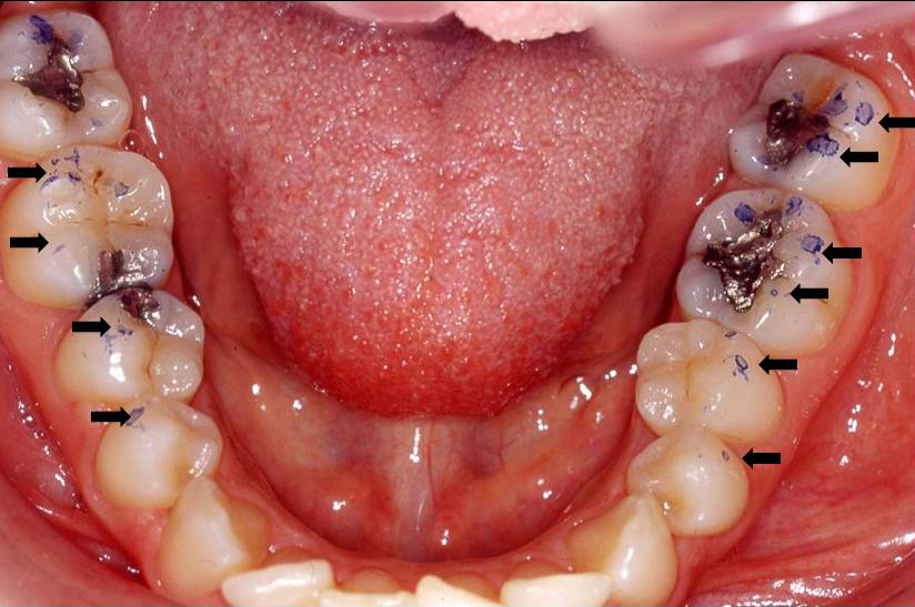 Gnatologia clinica - sandro prati